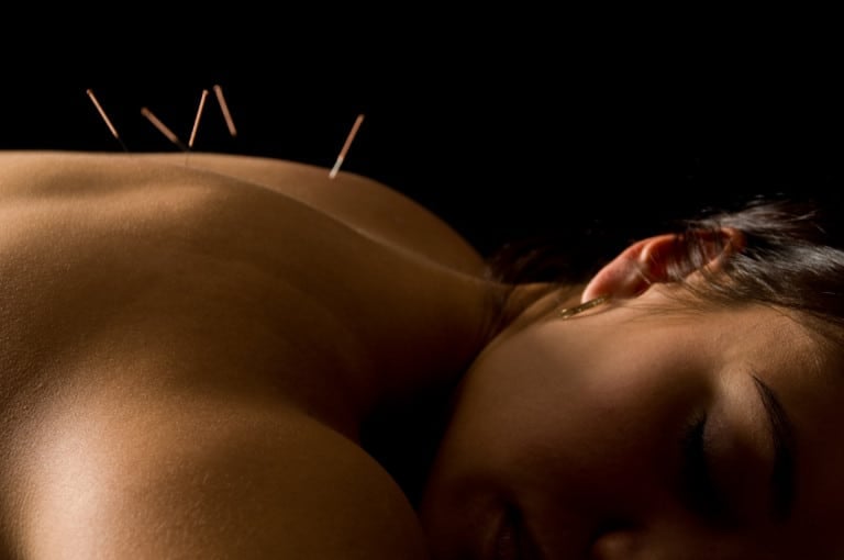 How to Pick An Acupuncturist